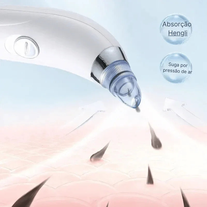 Aparelho de sucção facial com ponteira azul removendo impurezas da pele, tecnologia a vácuo.